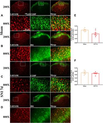 5-HT1F Receptor Agonist Ameliorates Mechanical Allodynia in Neuropathic Pain via Induction of Mitochondrial Biogenesis and Suppression of Neuroinflammation